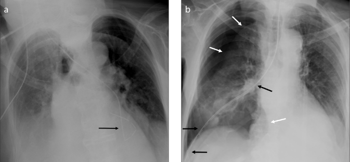 Figure 11. a, b