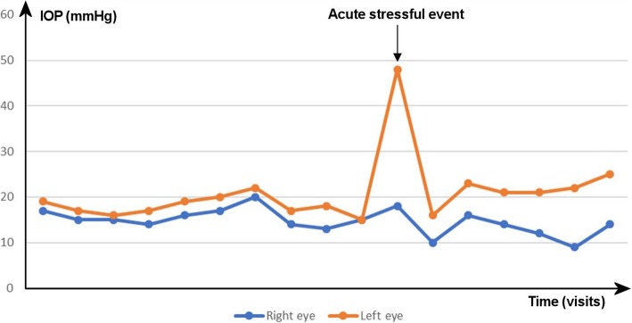 Fig. 4