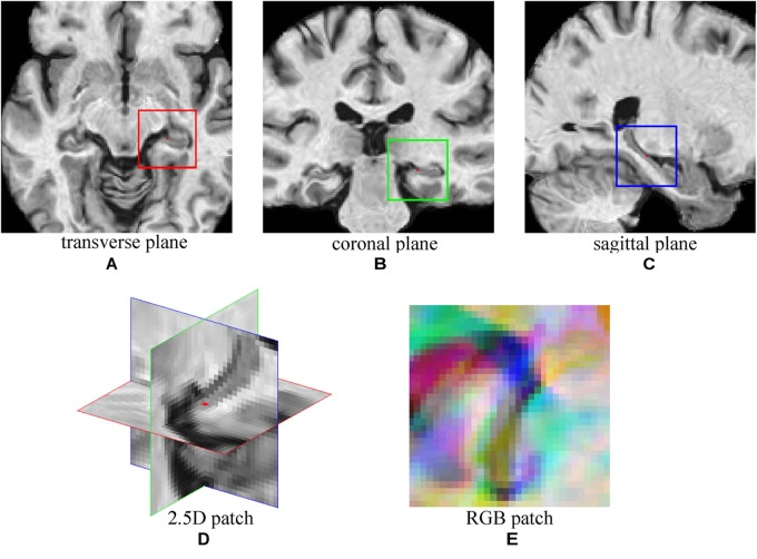 FIGURE 2