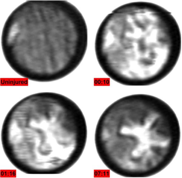 Fig. 15