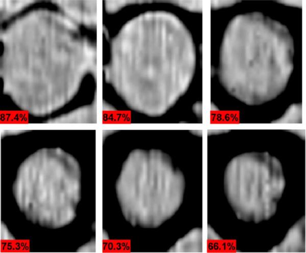 Fig. 18