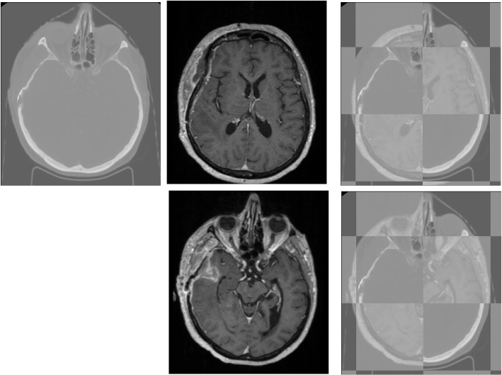 Fig. 2