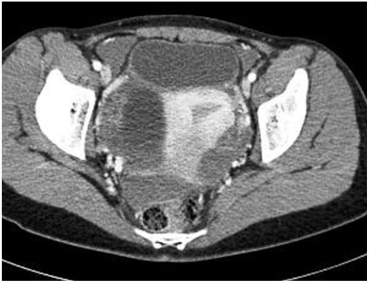 Fig. 1