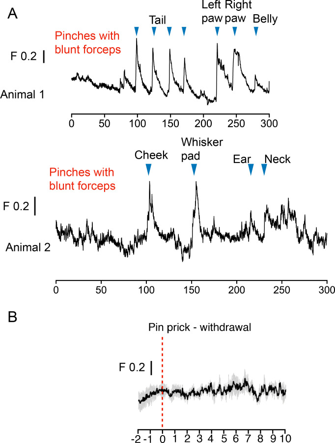 Figure 4—figure supplement 1.