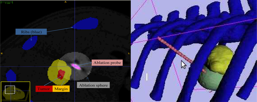 Fig. 12