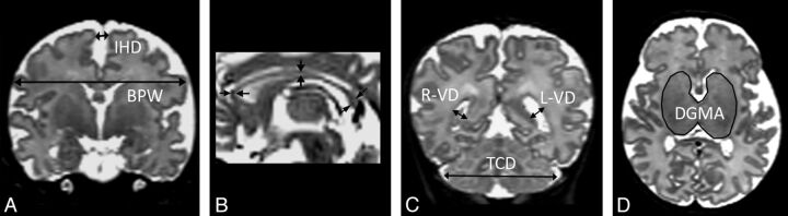 Fig 2.