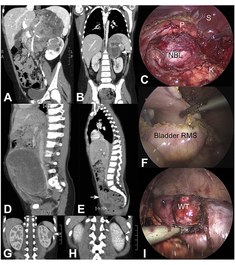 Fig 2.