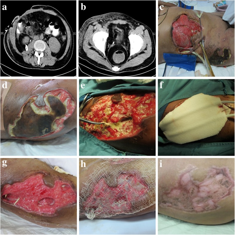 Fig. 2