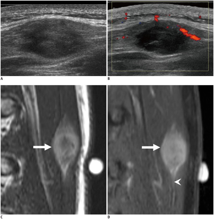 Fig. 11