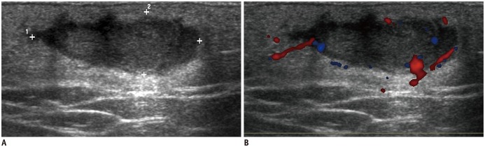 Fig. 17