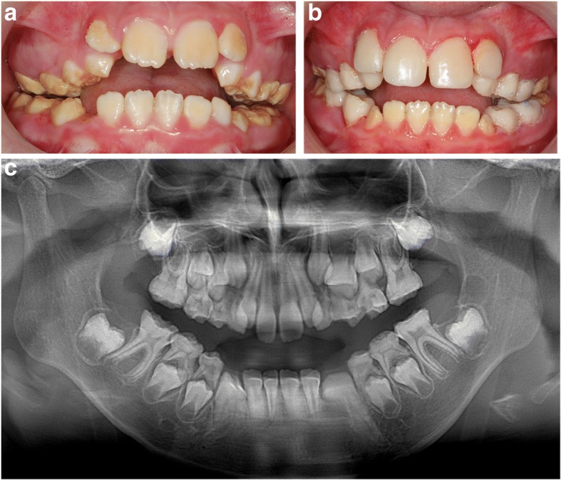 Fig. 2