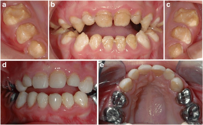 Fig. 1