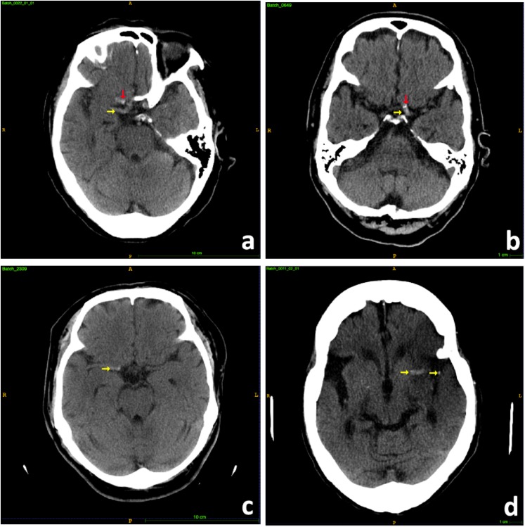 FIGURE 2