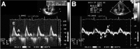 Fig. (3)