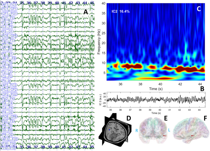 Figure 4