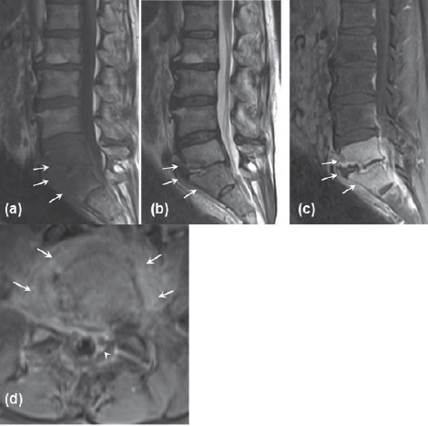 Figure 12