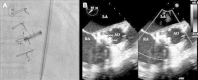 Fig. 5