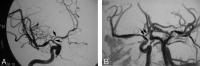 Fig 2.