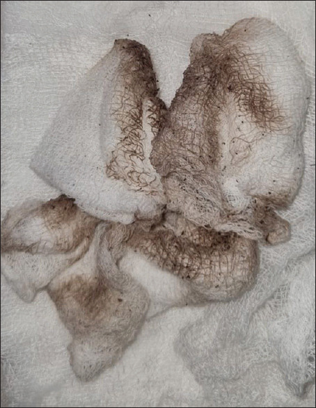 Figure 12