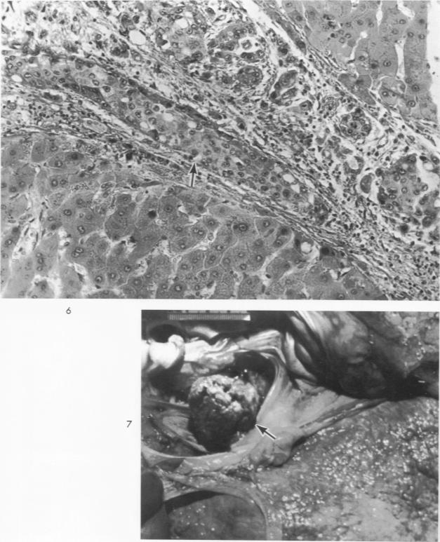 Figs 6 and 7