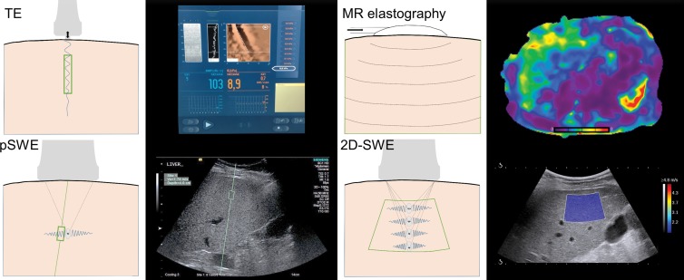 Figure 1: