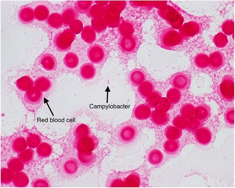 Figure 1