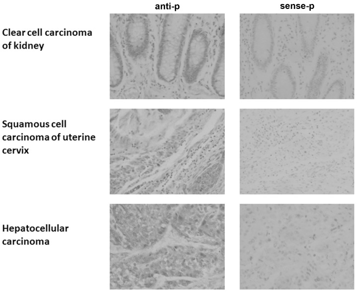 Expression Profile And Promoter Analysis Of Hepis - Pmc