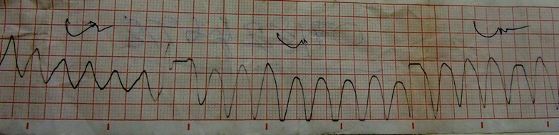 Fig. 1