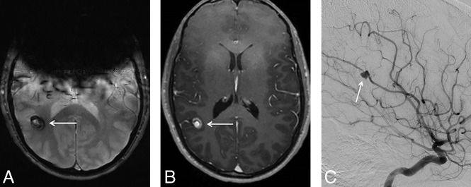 Fig 2.