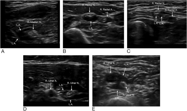 Fig. 4