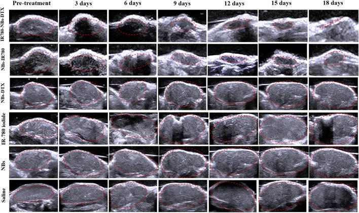 Figure 13