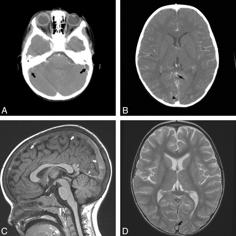 Fig 2.