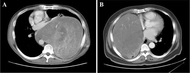 Fig. 1