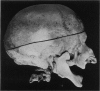 236-1