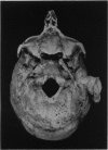 236-3