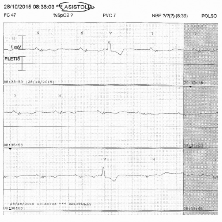 Figure 16