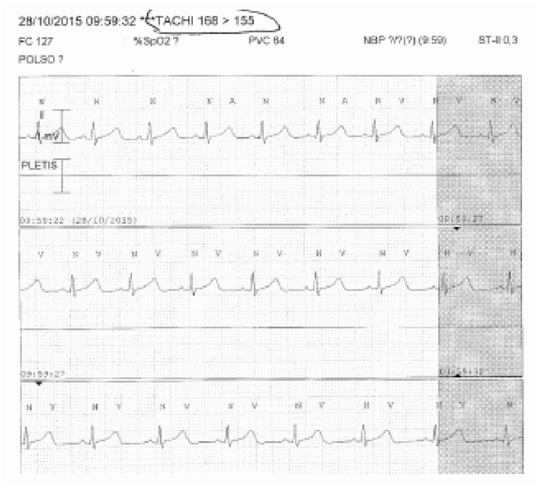 Figure 14