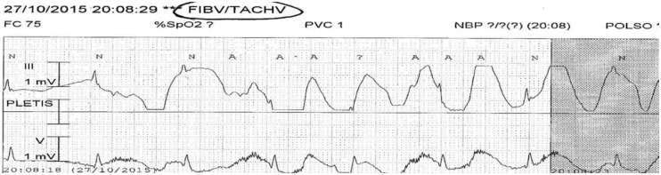 Figure 15