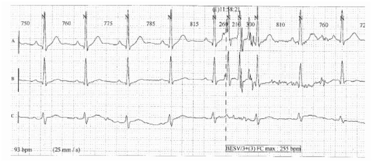 Figure 17