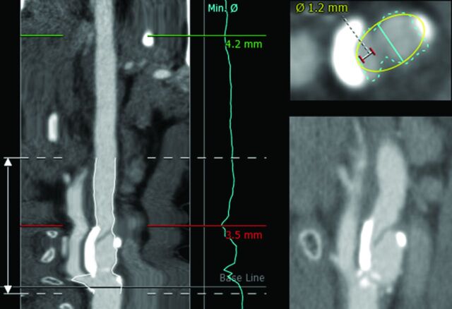 Fig 6.