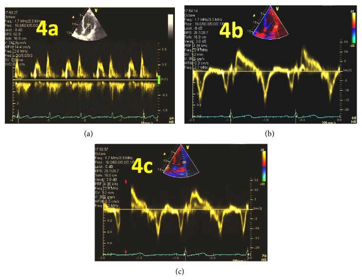 Figure 4