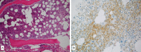 Figure 2A-B