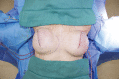 Fig. 9.