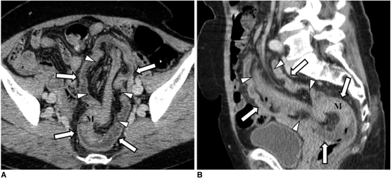 Fig. 14