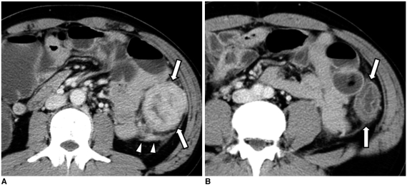 Fig. 12