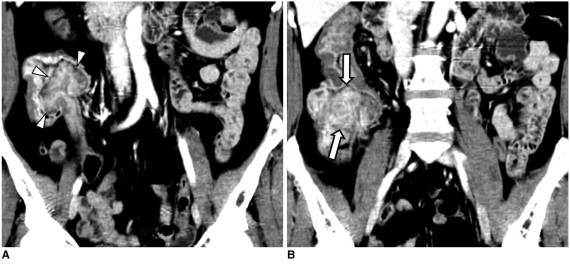 Fig. 13