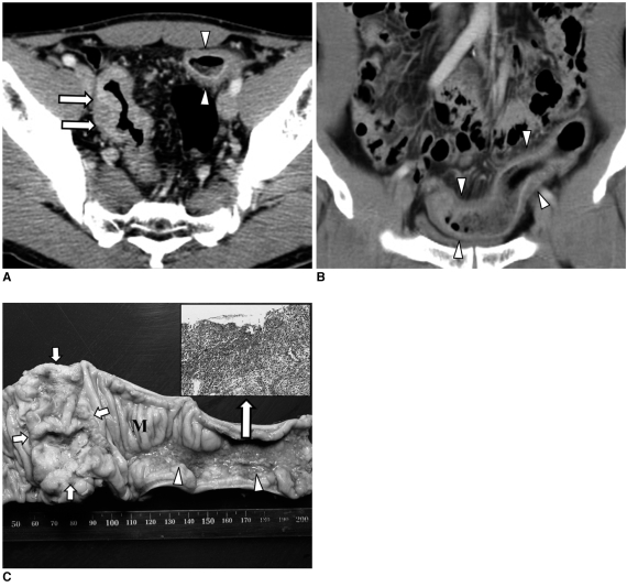 Fig. 11