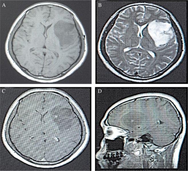 Fig.2