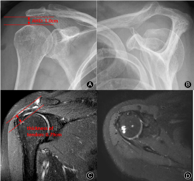 Fig. 10