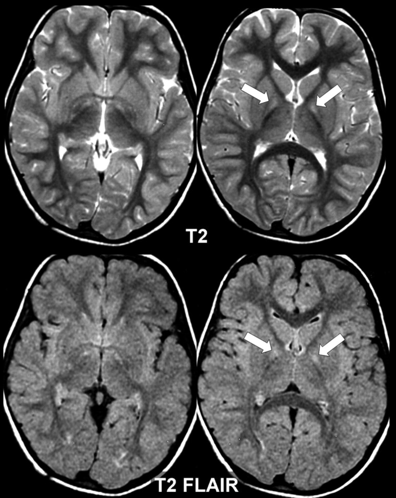 Fig 2.